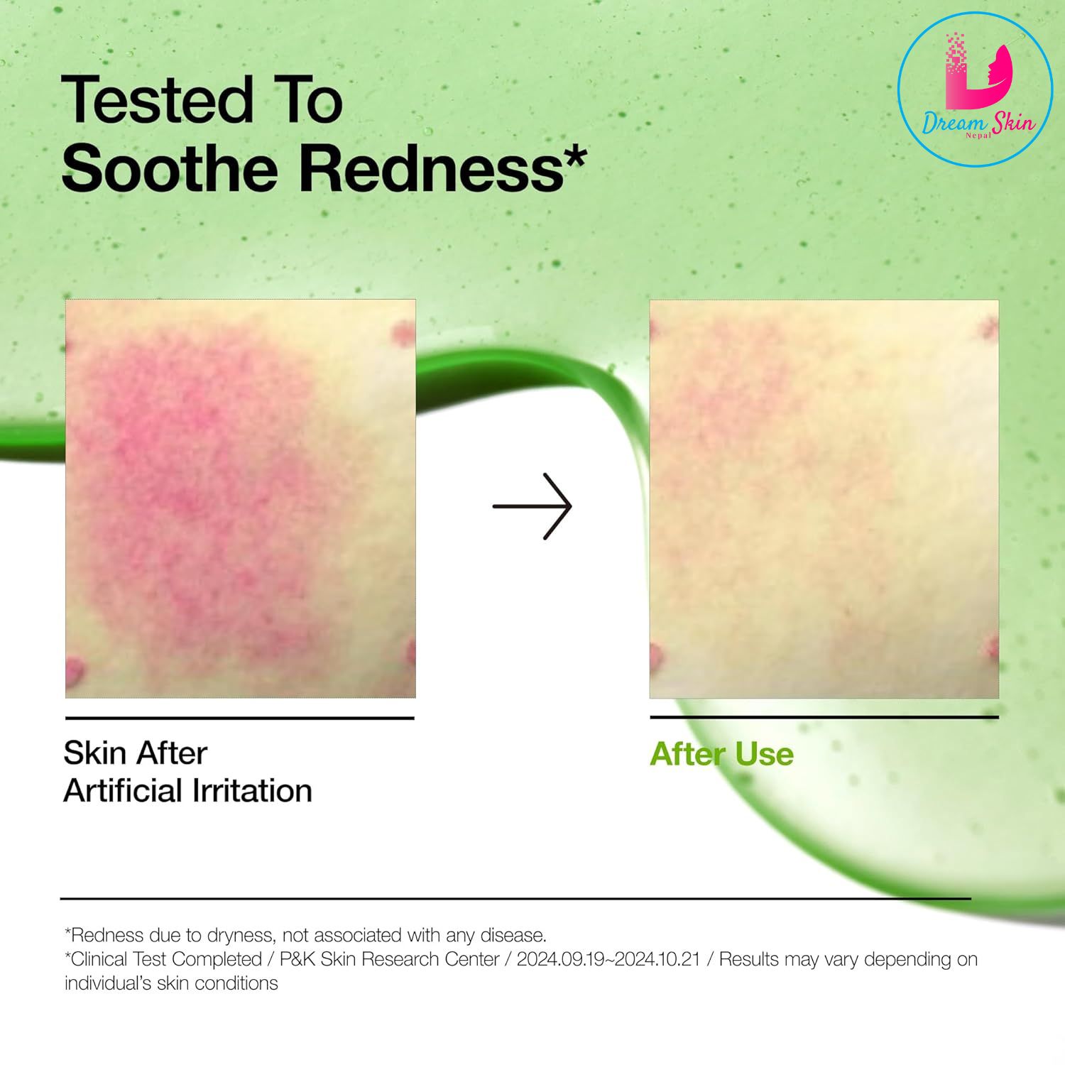 Anua Azelaic Acid 10 Hyaluron Redness Soothing Serum [30ml]